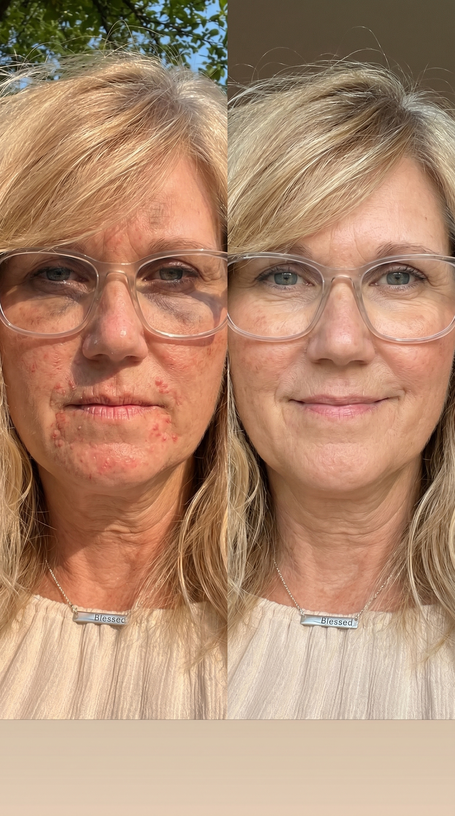 Real Quiet Retinol result
